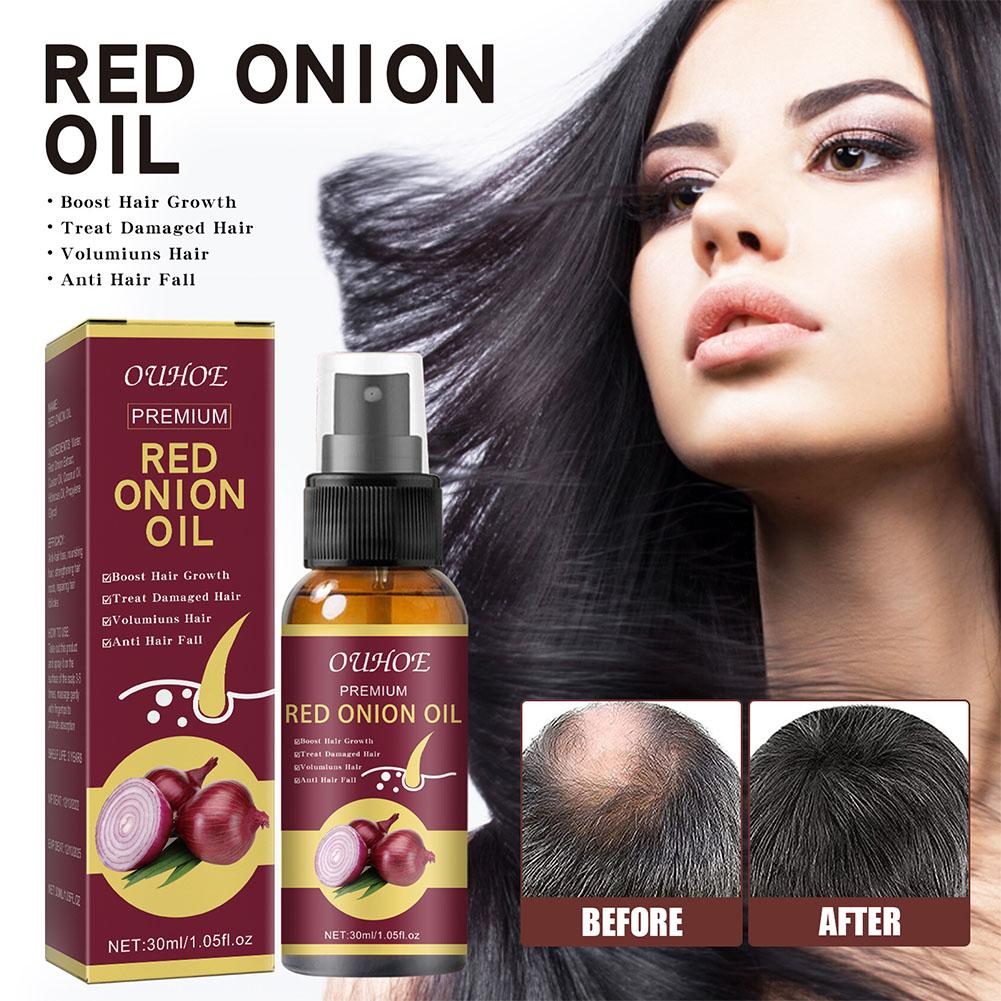 Hair Care Ouai - OUHOE Red Onion Essential Oil Spray
