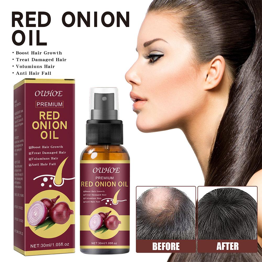 OUHOE Red Onion Essential Oil  - Hair Care Ouai recension och pris